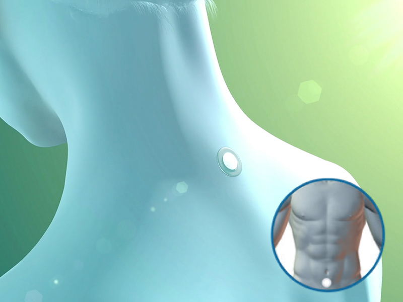 patch-neck-bellyPlacement